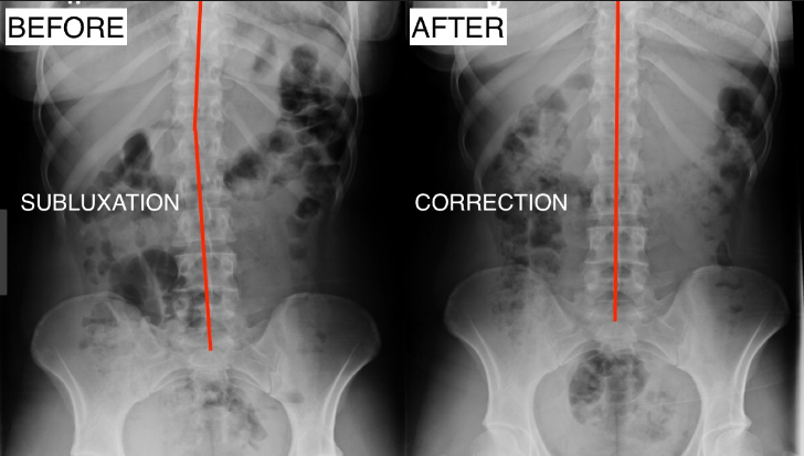 X-Ray Analysis