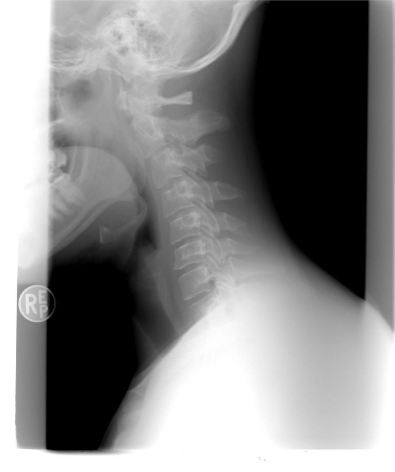 Best Chiropractic Malaysia Practices