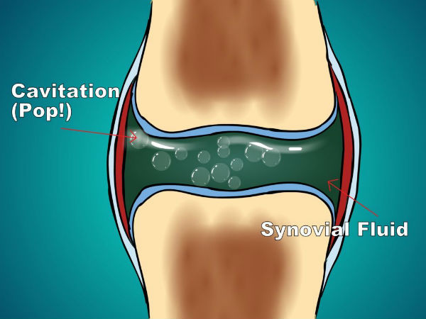 What Is Chiropractic Adjustment