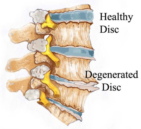 top 10 reasons for back pain