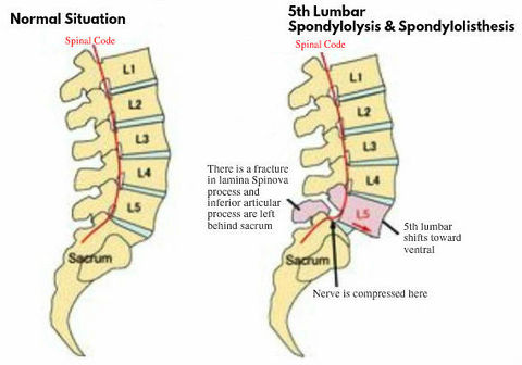 top 10 reasons for back pain