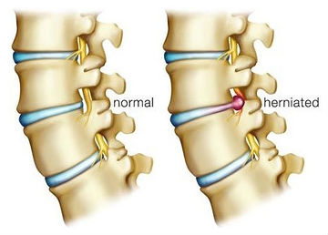 top 10 reasons for back pain
