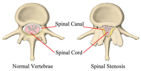 top 10 reasons for back pain