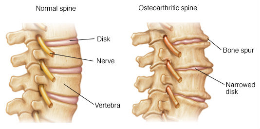 top 10 reasons for back pain