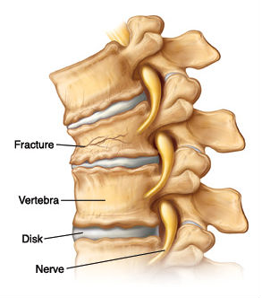 top 10 reasons for back pain