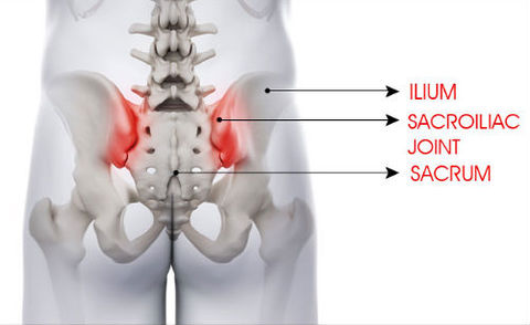 top 10 reasons for back pain