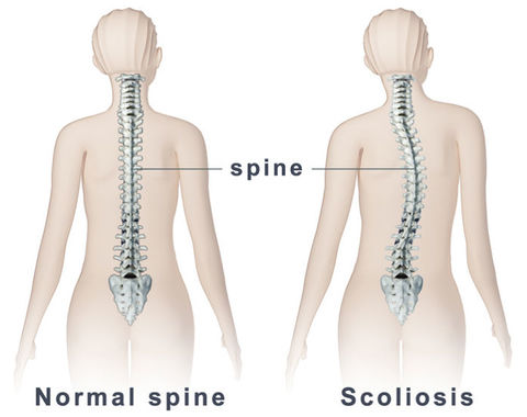 top 10 reasons for back pain