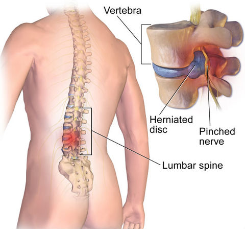 top 10 reasons for back pain