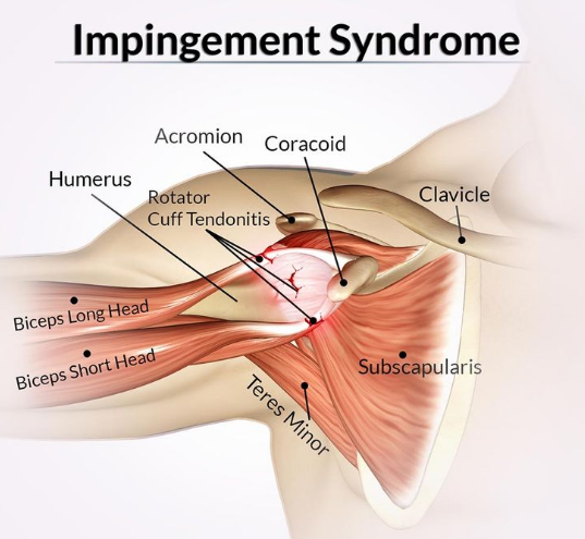 Top 10 Most Common Sports Injuries