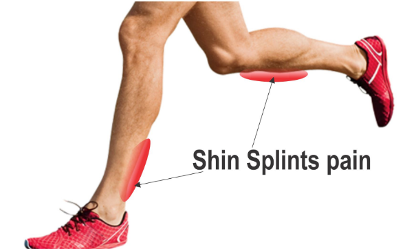 Top 10 Most Common Sports Injuries